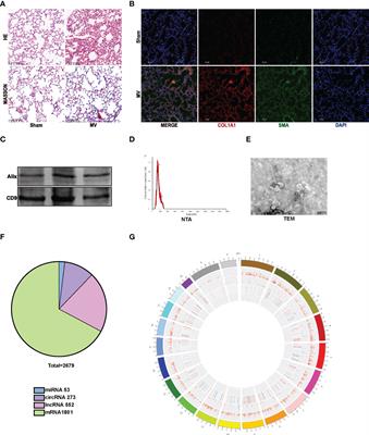 Non-coding RNA alterations in extracellular vesicles from bronchoalveolar lavage fluid contribute to mechanical ventilation-induced pulmonary fibrosis